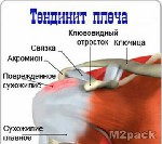 أصول الترقوة وإدخال العضلات والرباط