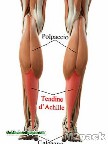 Gastrocnemius أو التوائم