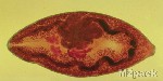 بحث عن الديدان الاسطوانية والدوارات - الديدان الدبوسية