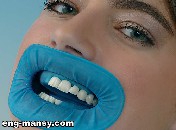 A rubber dam or dental dam is a rectangular sheet of latex used by dentists, especially for root canal treatment, but also for things like tooth coloured rubber dam